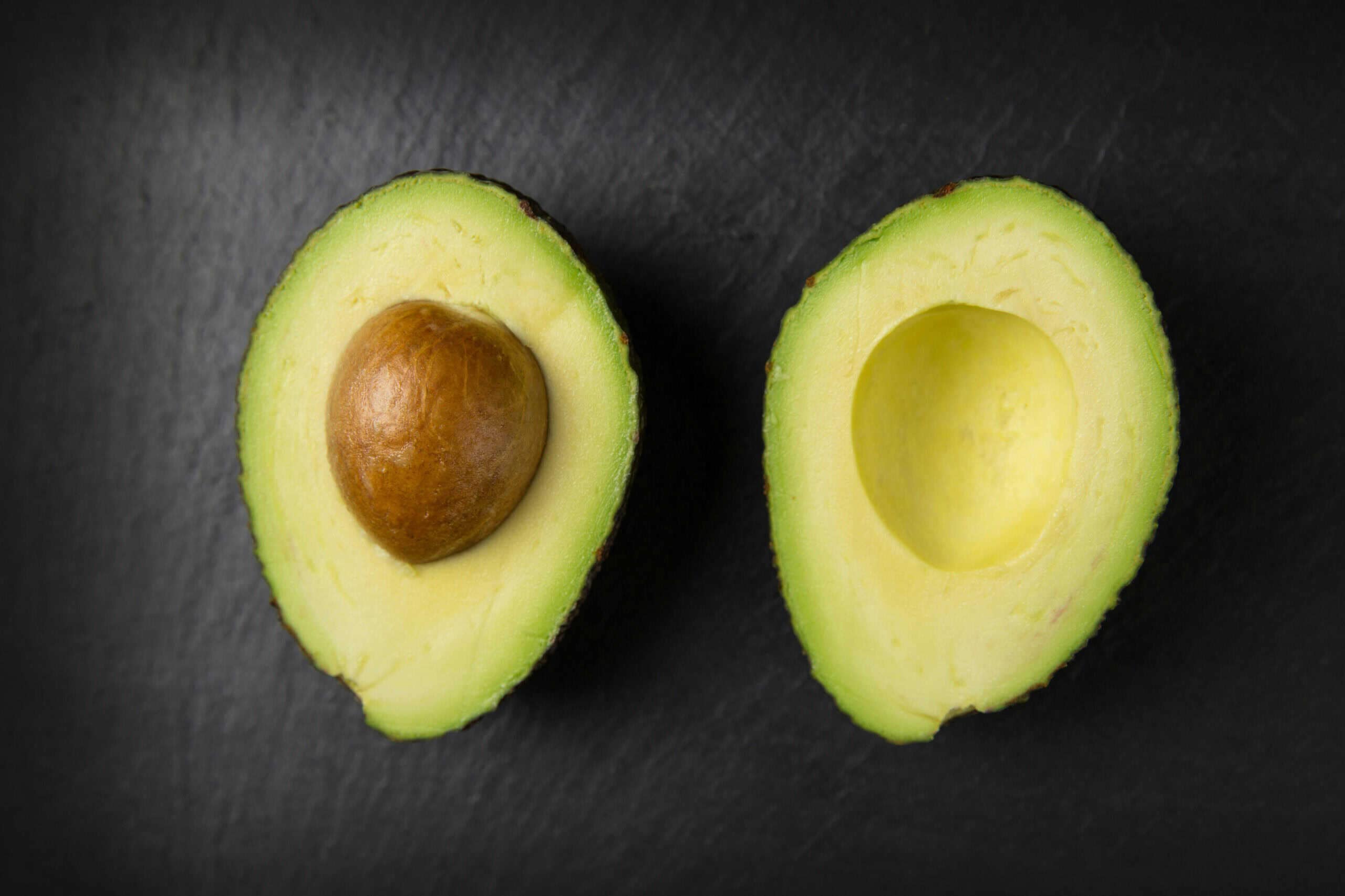 4. Avocados: Green Gold and Social Costs